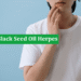 Black Seed Oil Herpes