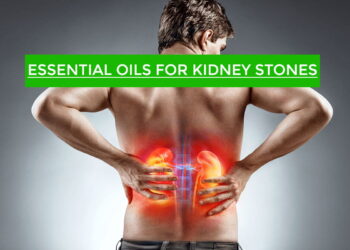 Essential Oils for Kidney Stones
