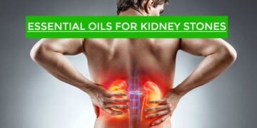 Essential Oils for Kidney Stones