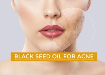 Black Seed Oil for Acne