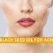 Black Seed Oil for Acne