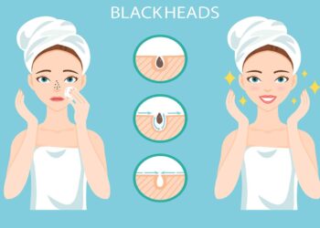 Essential Oils for Blackheads