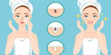 Essential Oils for Blackheads