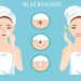 Essential Oils for Blackheads