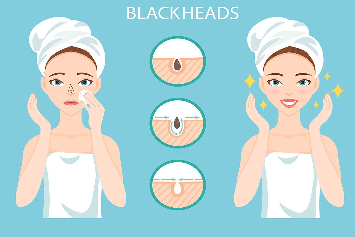 Will Essential Oils for Blackheads Work more than a Scrub