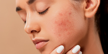 Dermatology Conferences
