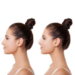 Rhinoplasty Surgeons in Sydney