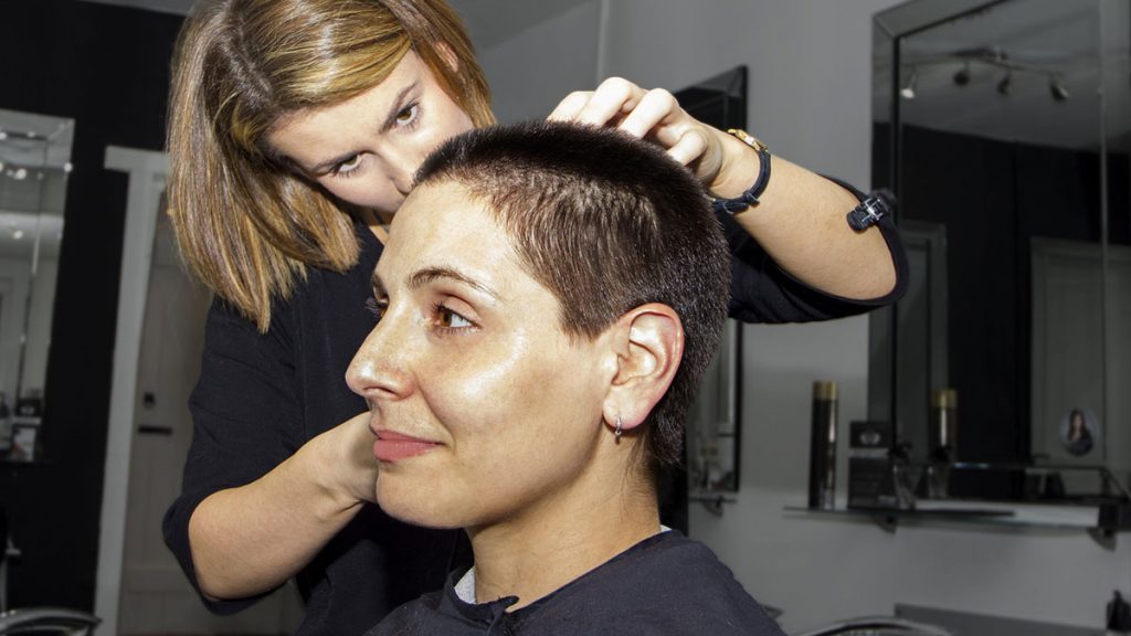 Hair replacement systems