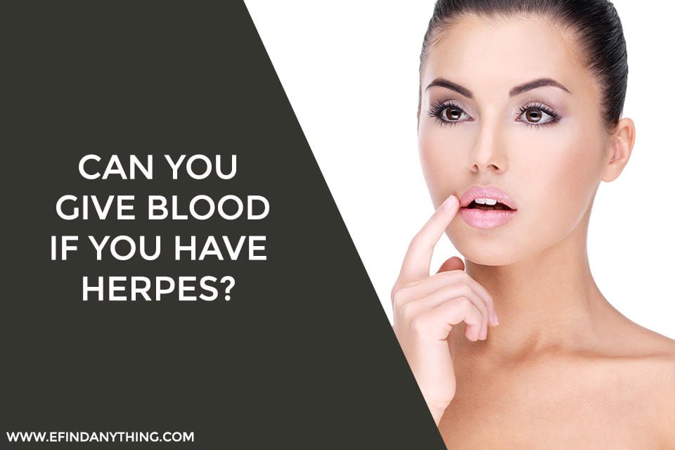 Can You Give Blood If You Have Herpes? [Yes! But Cautious]