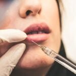 Cosmetic Surgeries