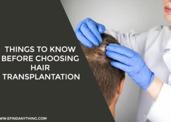 Things To Know Before Choosing Hair Transplantation