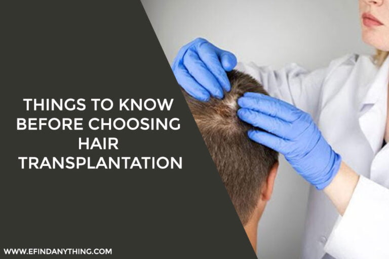 Things To Know Before Choosing Hair Transplantation