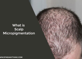 What is Scalp Micropigmentation