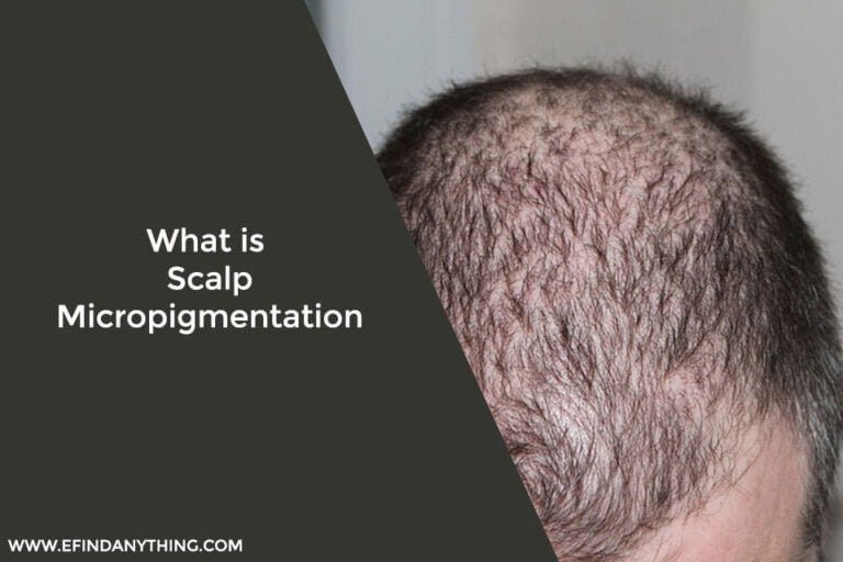 What is Scalp Micropigmentation