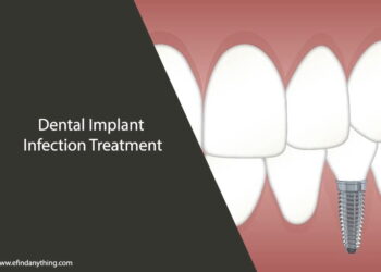 Dental Implant Infection Treatment