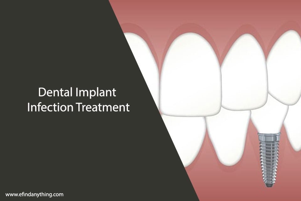 Dental Implant Infection Treatment