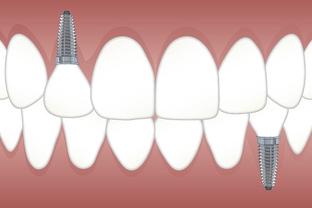 Dental Implant Infection Treatment