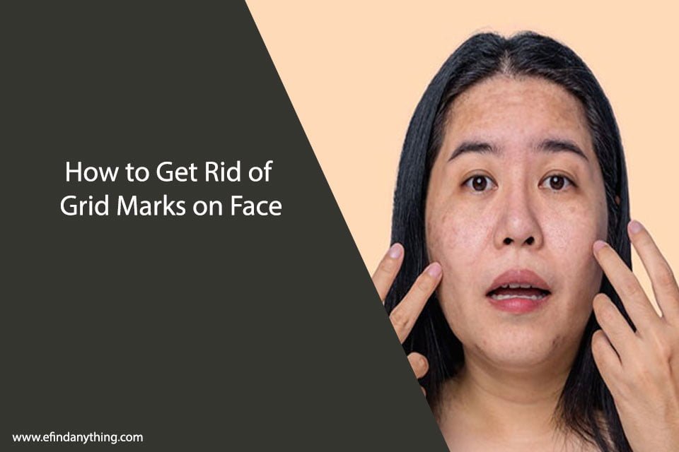 How to Get Rid of Grid Marks on Face