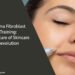 Plasma Fibroblast Training