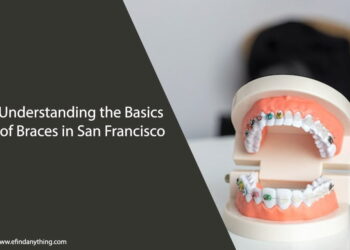 Braces in San Francisco