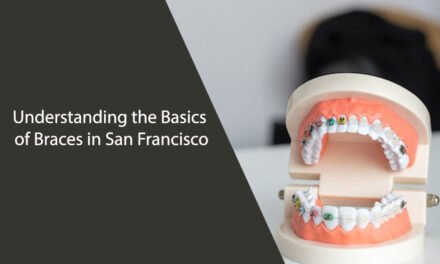 Understanding the Basics of Braces in San Francisco