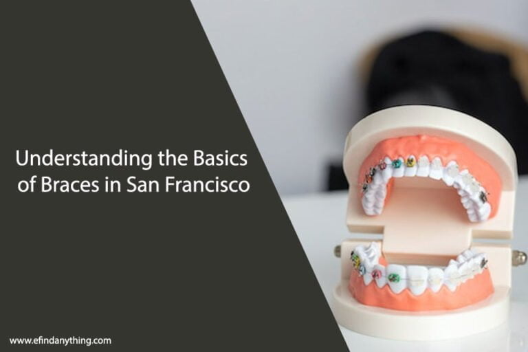 Braces in San Francisco
