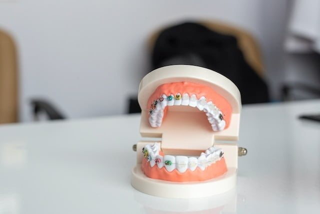 Braces in San Francisco