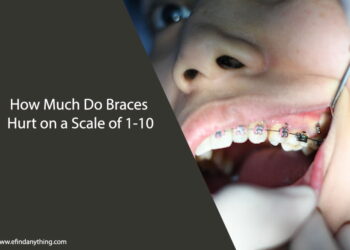 How Much Do Braces Hurt on a Scale of 1-10