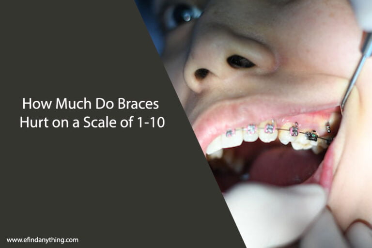 How Much Do Braces Hurt on a Scale of 1-10
