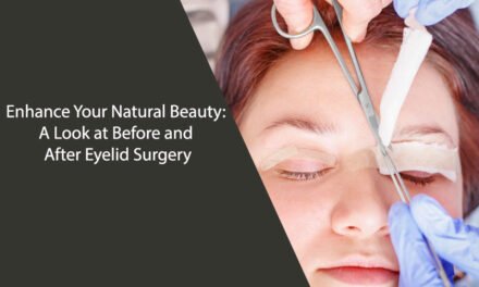 Enhance Your Natural Beauty: A Look at Before and After Eyelid Surgery