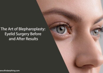 Eyelid Surgery Before and After Results