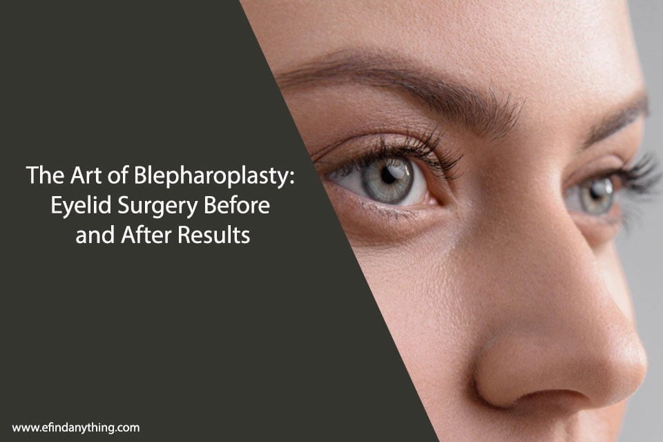 Eyelid Surgery Before and After Results