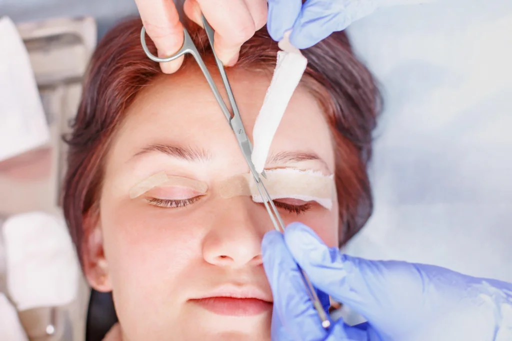 Before and After Eyelid Surgery