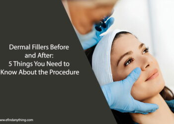 Dermal Fillers Before and After: 5 Things You Need to Know About the Procedure