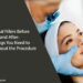 Dermal Fillers Before and After: 5 Things You Need to Know About the Procedure