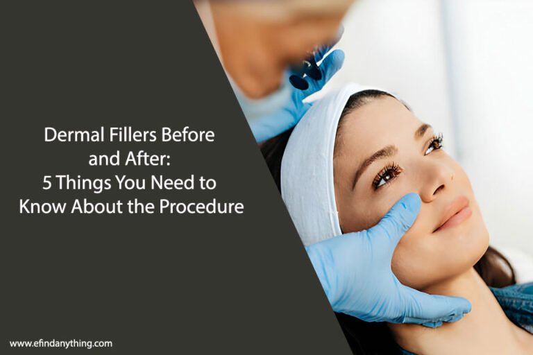 Dermal Fillers Before and After: 5 Things You Need to Know About the Procedure