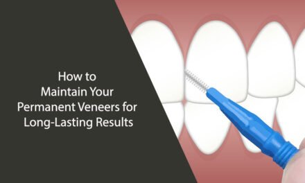 How to Maintain Your Permanent Veneers for Long-Lasting Results