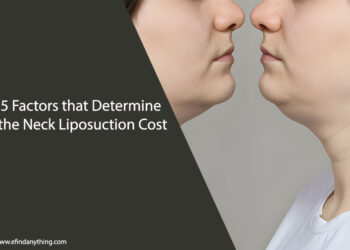 Neck Liposuction