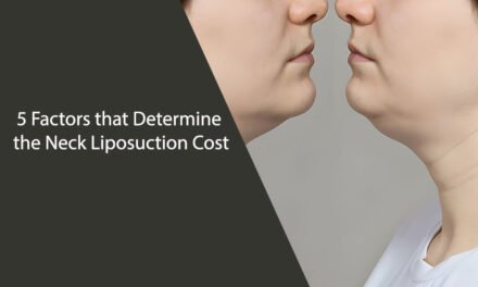 5 Factors that Determine the Neck Liposuction Cost