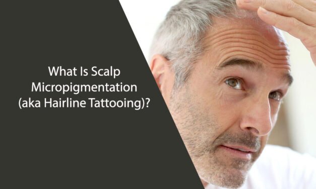 What Is Scalp Micropigmentation (aka Hairline Tattooing)?
