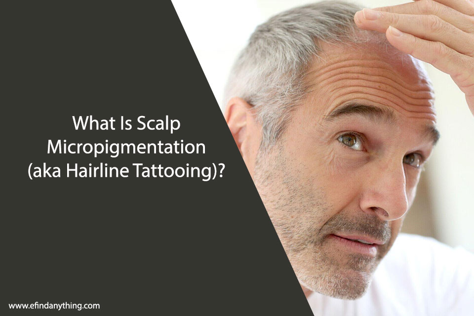 Scalp Micropigmentation