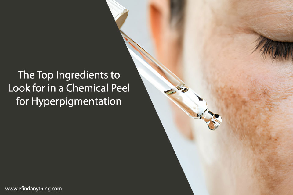 Chemical Peel for Hyperpigmentation