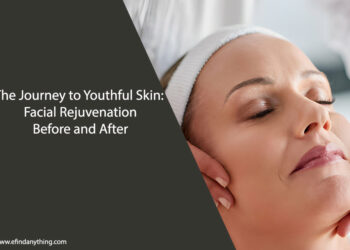 Facial Rejuvenation Before and After
