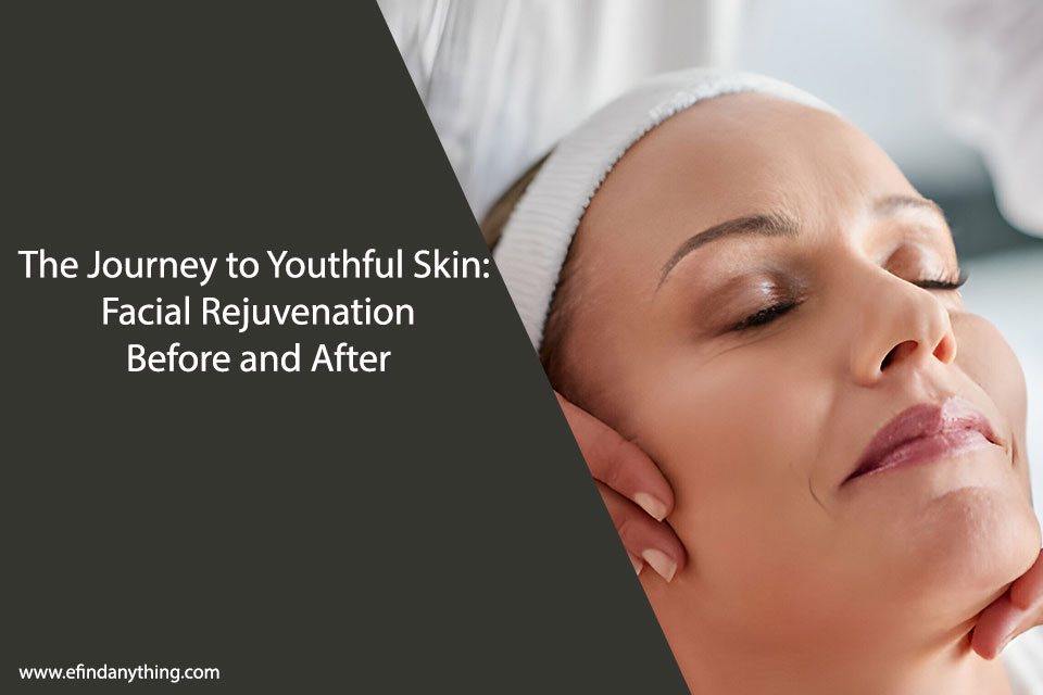 Facial Rejuvenation Before and After