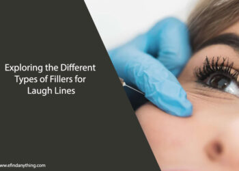 Fillers for Laugh Lines
