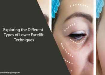 Lower Facelift Techniques