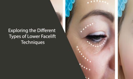 Exploring the Different Types of Lower Facelift Techniques