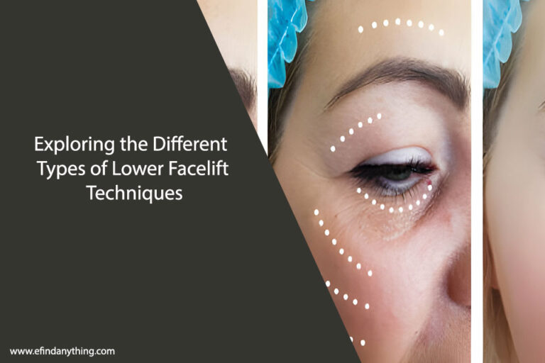 Lower Facelift Techniques