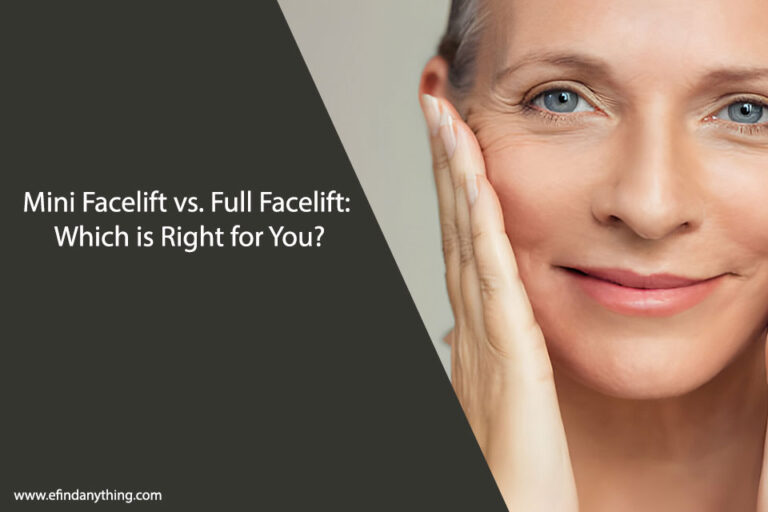 Mini Facelift vs. Full Facelift