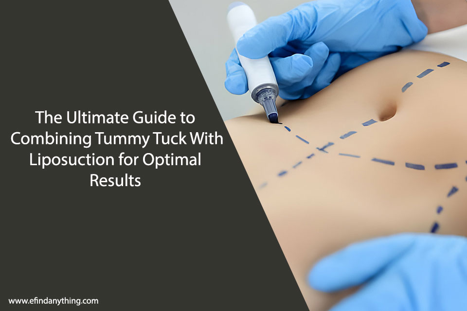 Tummy Tuck With Liposuction